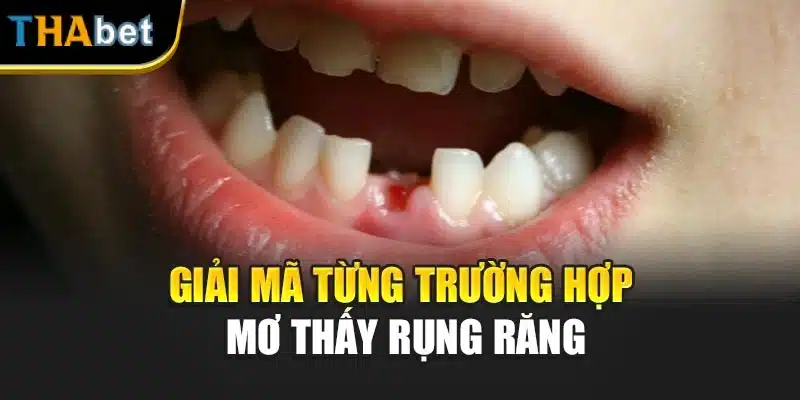 Giải mã từng trường hợp mơ thấy rụng răng